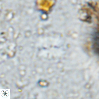 Watznaueria bayackii VR 14312