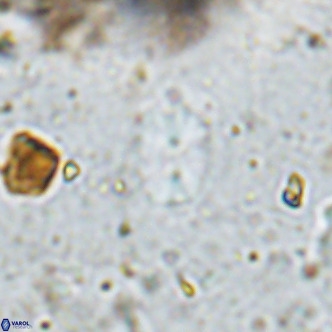 Watznaueria bayackii VR 14316