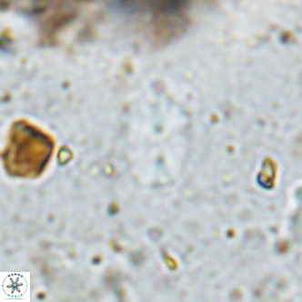 Watznaueria bayackii VR 14316