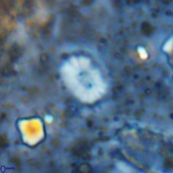Watznaueria bayackii VR 14320