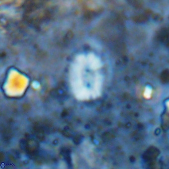 Watznaueria bayackii VR 14322