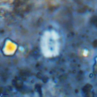 Watznaueria bayackii VR 14323