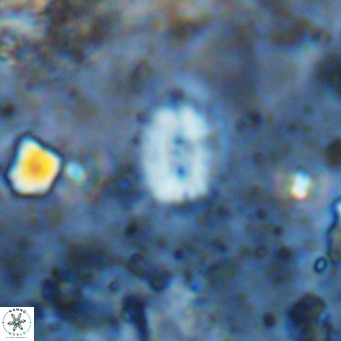 Watznaueria bayackii VR 14323