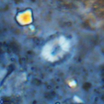 Watznaueria bayackii VR 14324