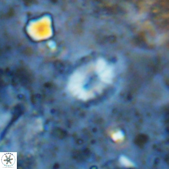 Watznaueria bayackii VR 14324