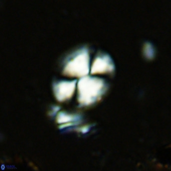 Watznaueria bayackii VR 15840