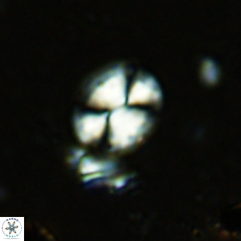 Watznaueria bayackii VR 15840