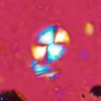Watznaueria bayackii VR 15841