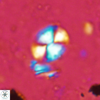 Watznaueria bayackii VR 15841