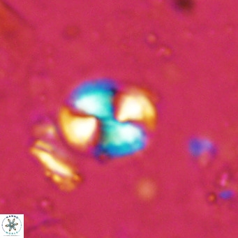 Watznaueria bayackii VR 15842