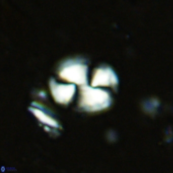 Watznaueria bayackii VR 15843