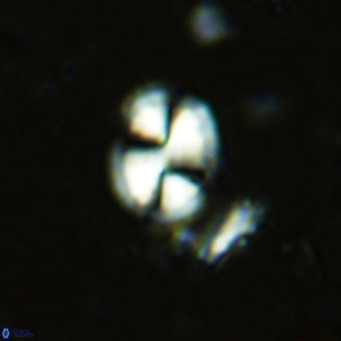 Watznaueria bayackii VR 15844