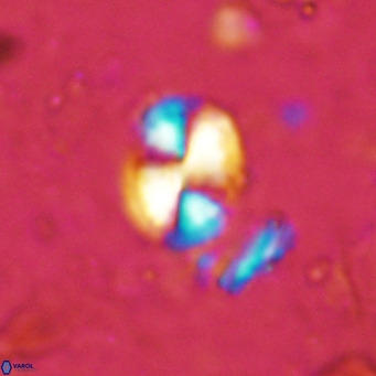Watznaueria bayackii VR 15845
