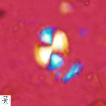 Watznaueria bayackii VR 15845