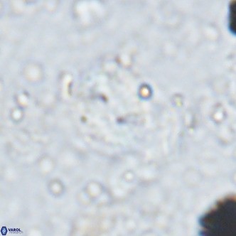 Watznaueria bayackii VR 15849