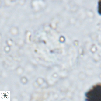 Watznaueria bayackii VR 15849