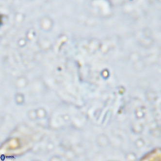 Watznaueria bayackii VR 15850