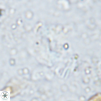 Watznaueria bayackii VR 15850