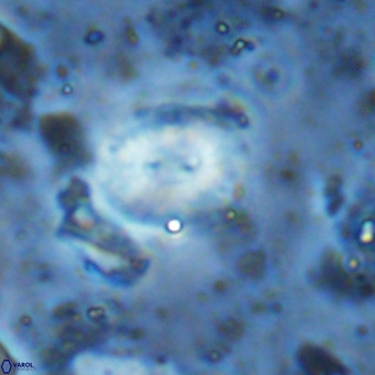 Watznaueria bayackii VR 15853