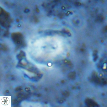 Watznaueria bayackii VR 15853
