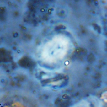 Watznaueria bayackii VR 15854