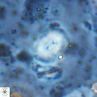 Watznaueria bayackii VR 15854