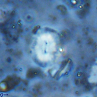 Watznaueria bayackii VR 15855