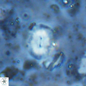Watznaueria bayackii VR 15855