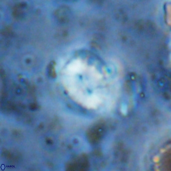 Watznaueria bayackii VR 15856
