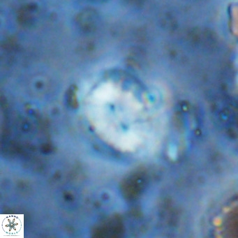 Watznaueria bayackii VR 15856