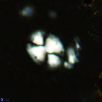Watznaueria bayackii VR 15833