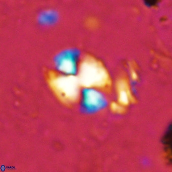 Watznaueria bayackii VR 15834