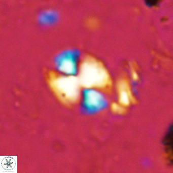 Watznaueria bayackii VR 15834