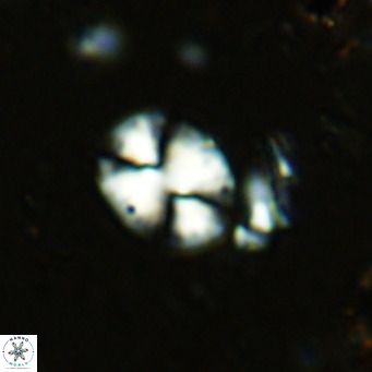 Watznaueria bayackii VR 15835