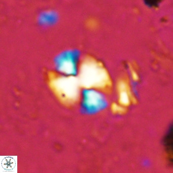 Watznaueria bayackii VR 15836