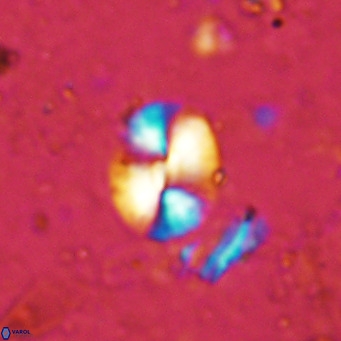 Watznaueria bayackii VR 15837