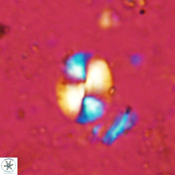 Watznaueria bayackii VR 15837