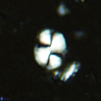 Watznaueria bayackii VR 15838
