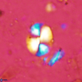 Watznaueria bayackii VR 15839