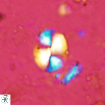 Watznaueria bayackii VR 15839