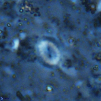 Watznaueria bayackii VR 16187