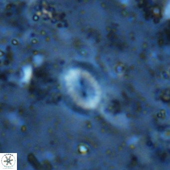 Watznaueria bayackii VR 16187