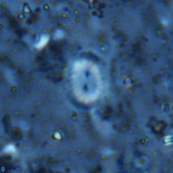 Watznaueria bayackii VR 16188