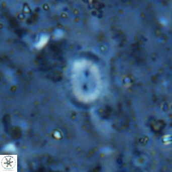 Watznaueria bayackii VR 16188
