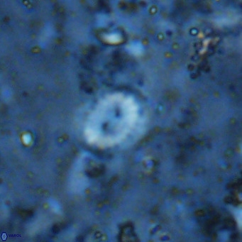 Watznaueria bayackii VR 16190