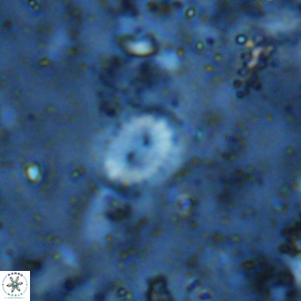 Watznaueria bayackii VR 16190