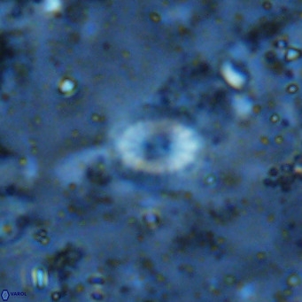 Watznaueria bayackii VR 16193