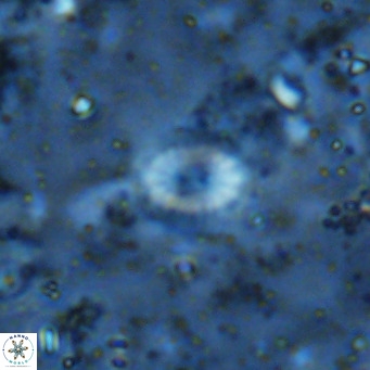 Watznaueria bayackii VR 16193