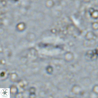 Watznaueria bayackii VR 16194