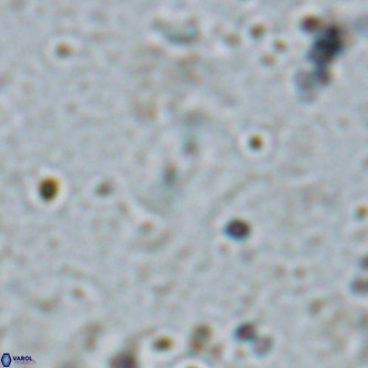 Watznaueria bayackii VR 16195
